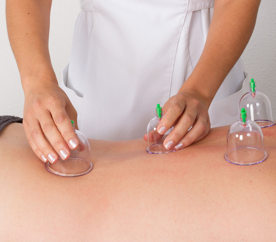 Cupping Massage Therapy